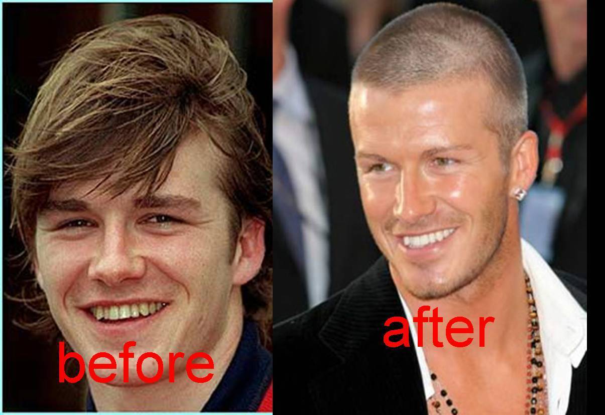 before and after david